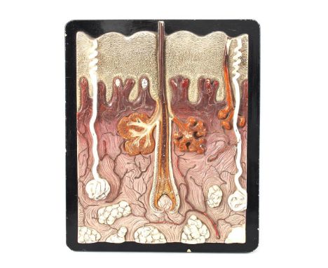 Plaster anatomical model of the skin, 36x30 cm