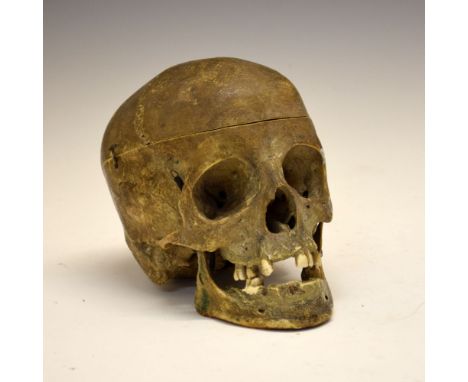 Medical/Dental Interest - Human skull, believed to have been used circa 1940's in Dental School studies, having removeable up