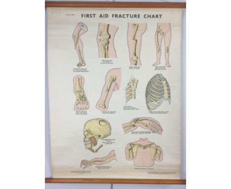 LARGE VINTAGE ANATOMICAL CHART BY ADAM, ROUILLY &amp; CO. LTD, showing a 'First Aid Fracture Chart', 100cm high, 75cm wide