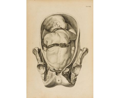 Smellie (William) A Sett of Anatomical Tables...of the Practice of Midwifery, second edition, 39 engraved plates by Grignion 