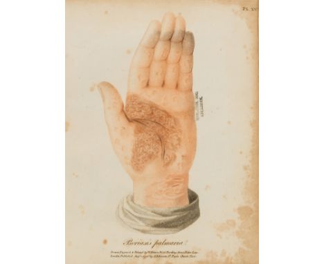 Dermatology.- Willan (Robert) On Cutaneous Diseases, 4 parts, title to first part only, 34 stipple-engraved plates printed in