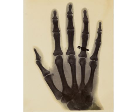 Teall (Sir Jethro Justinian Harris, geologist, 1849-1924) X-ray print of Alvina Bertram C Casey's left hand taken by Teall, 2