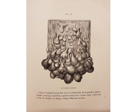 Cripps (Harrison). On Diseases of the Rectum and Anus, including a portion of the Jacksonian Prize Essay on cancer, 1st editi