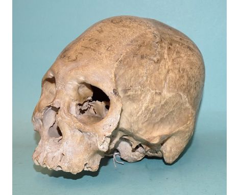 An antique human skull, (a/f, lower mandible and zygomatic arches lacking). 