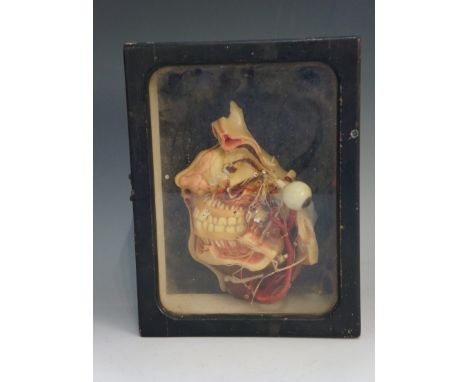 An anatomically correct cross section model displaying part of a human head, within glazed case, 25cm high, 19cm wide, 8cm de