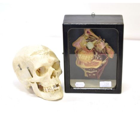 Human Skull with sprung jaw and removable top; together with a three dimensional wax medical model of the interior of the fac