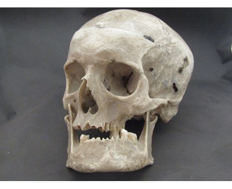 A human skull