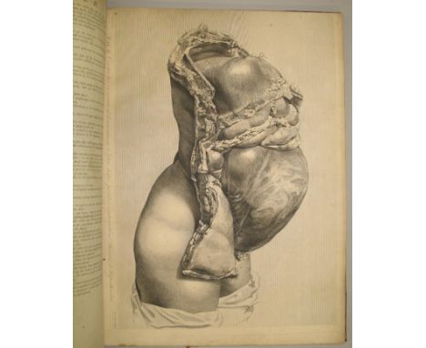 HUNTER (William) [The Anatomy of the Human Gravid Uterus exhibited in Figures] large folio, lacking title-page, most of the p