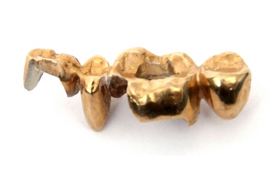 sell gold tooth crown