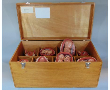 Wooden trunk containing  educational  display models of embryo - foetus development 