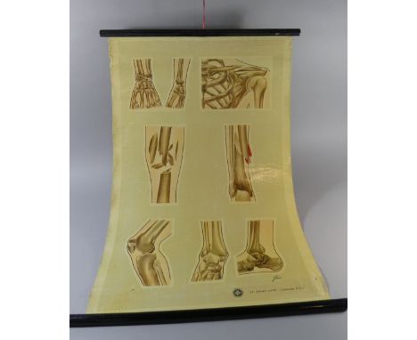 A Vintage St.Johns Ambulance Poster Depicting Broken Bones, After J Teck, 85cm Long