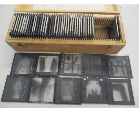 1930 magic lantern slides and glass plates of medical interest showing X-rays of fractured bones 