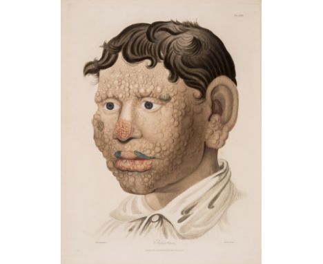 Dermatology.- Baterman (Thomas) Delineations of Cutaneous Diseases, new edition, 72 engraved plates printed in colours and fi