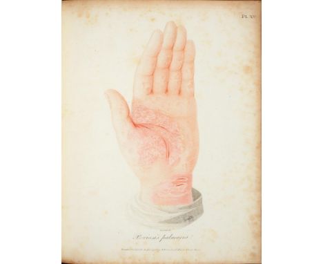 WILLAN, ROBERT ON CUTANEOUS DISEASESLondon, J Johnson, 1808. First edition, volume 1 (all published), 34 hand-coloured plates