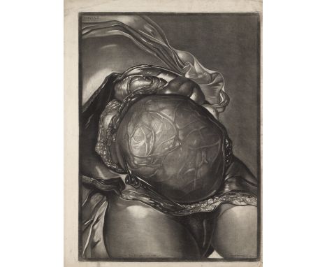 Medizin - - Johann Michael Seligmann. Sammlung von 5 Mezzotintoradierungen. Tafel II-VI aus: Demonstrations of a Pregnant Ute