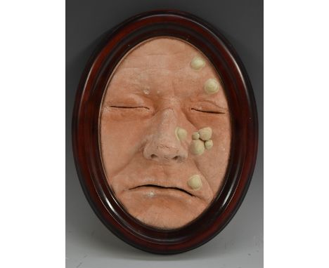 Medical Interest - a macabre plaster death mask, of a small pox victim, modelled with pustules, oval, 16cm x 11cm, 20th centu
