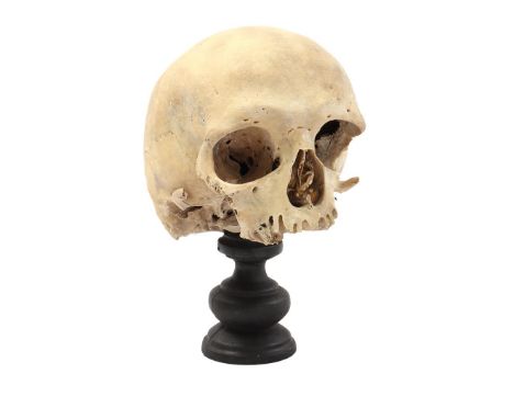 Part of an old skull, on stand 23 cm high
