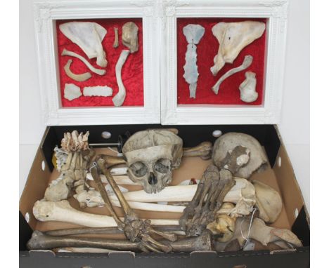 A box of human bones, incuding a half skull, articulated ankle with foot etc. originally from a school and used for medical p