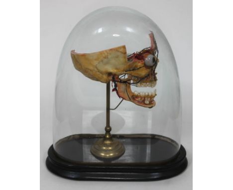 A human quarter cut skull showing eye, blood veins/arteries and teeth, on brass stand and housed within domed glass cover on 