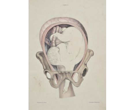 Spratt (George). Obstetric Tables: Comprising Coloured Delineations on a Peculiar Plan, Intended to Illustrate Elementary and