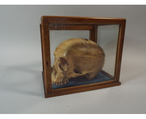 An Early 20th Century Doctors Model of A Human Skull in A Glazed Desk Top Cabinet, 23 x 20 x 16 Cm. 