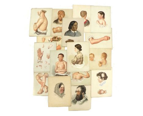 VICTORIAN MEDICAL PRINTS,19th century, depicting various diseases of the skin, including: Scabies, Herpes, Erythema, Sugar-Ba