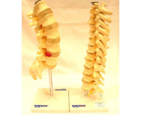 Two anatomical models of vertebrae one with prolapsed disc. P&amp;P Group 3 (£25+VAT for the first lot and £5+VAT for subsequ