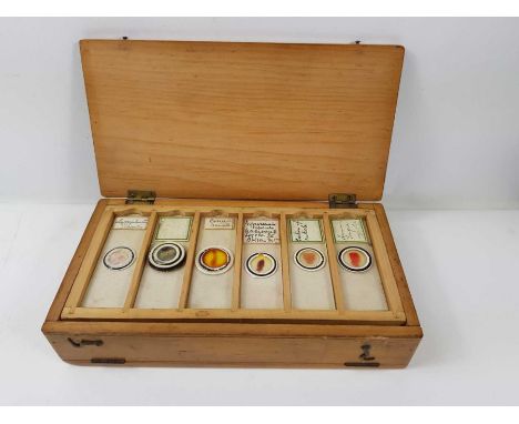 Thirty six glass microscope slides, each labelled, mainly human tissue samples, contained on trays in wooden box, early 20th 