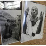 AFRICA, a group of 10 prints illustrating medical conditions of African people, photographed c.