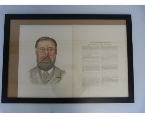 Large framed Lithograph of Skin Diseases and problems