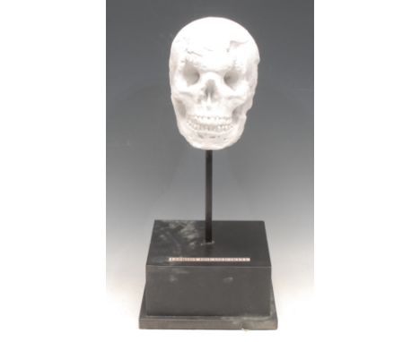 The Macabre - Medical Interest and Interior Decoration - a plaster facsimile, Leprosy Diseased Skull, mounted for display, 45
