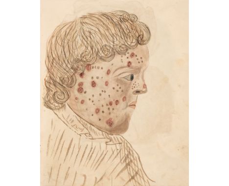 Leeds School of Medicine. Manuscript lecture notes compiled by F.M. Dowsland, pupil to Mr Wildsmith, c. 1832, containing neat