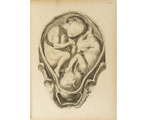 Smellie (William) A sett of anatomical tables, with explanations, and an abridgment of the practice of midwifery, first editi