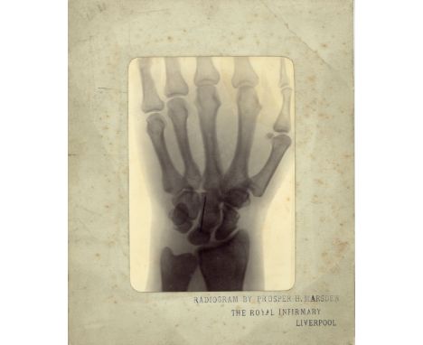 PROSPER H MARSDEN Three Early X-Rays,  c. 1902, vintage sepia gelatin silver print X-rays (radiographs or Rontgen ray photogr
