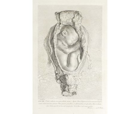 HUNTER (WILLIAM)Anatomia uteri humani gravidi tabulis illustrata. The Anatomy of the Human Gravid Uterus Exhibited in Figures