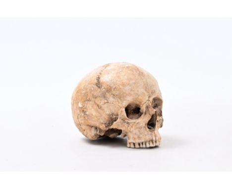 A human skull from an excavated archeological context, 18th C.H 15 - L 20,5 - D 15 cm