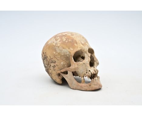 A human skull from an excavated archeological context, 18th C.H 15 - L 22 - D 15 cm