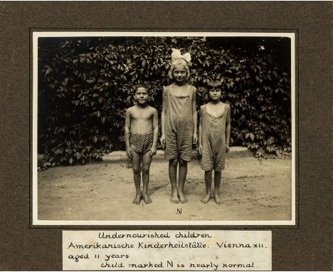 NO RESERVE Rickets.-  [The Meidling Children's Hospital, Vienna], 23 photographic prints, several captioned in manuscript, on