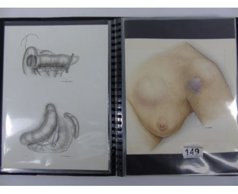 BOOK CONTAINING WATER COLOURS AND PENCIL  DRAWINGS OF VARIOUS HOSPITAL OPERATIONS AND PROCEDURES, SIGND BY, D M BARBER, POSSI