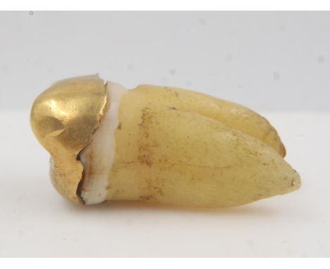 14ct gold crown affixed to tooth. UK P&amp;P Group 0 (£6+VAT for the first lot and £1+VAT for subsequent lots) 