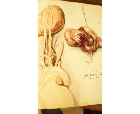MEDICAL CASE REPORTS, MID-19TH CENTURY: 'Reports of Cases at University College Hospital': A volume of manuscript case report