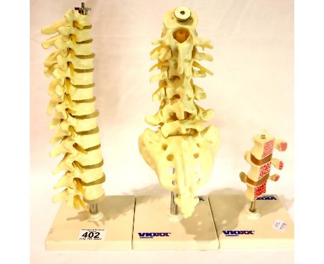 Three anatomical vertebral spine models. P&amp;P Group 3 (£25+VAT for the first lot and £5+VAT for subsequent lots) 