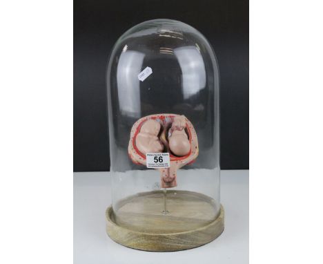 Anatomical Educational Teaching Model of Twin Babies in a Womb contained within a Glass Dome, 39cms high