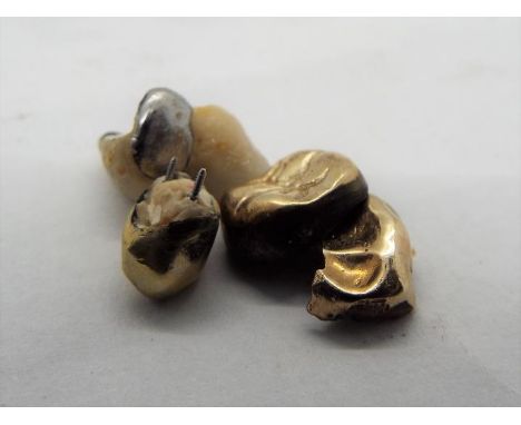 A collection of dental gold (still with enamel attached), approximately 5.4 grams all in.