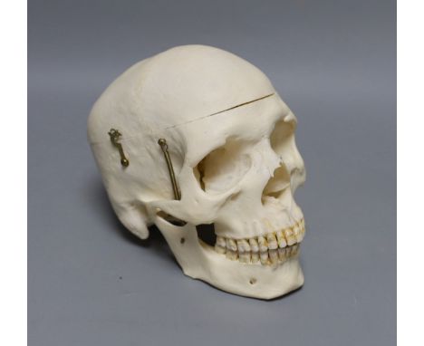 A human male skull, the vendor bought the item prior to 1977