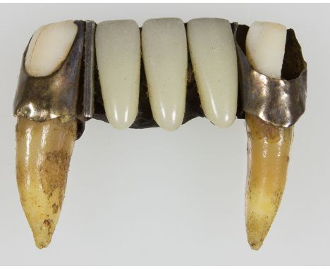 DENTAL BRIDGE FROM A JAPANESE SOLDIER K.I.A. AT IWO JIMAA particularly gruesome souvenir of World War II, a partial dental br