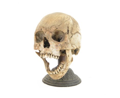 Antique human skull, articulated for medical use,the jaw now articulated with springs, upon a metal base, on base H24cm 