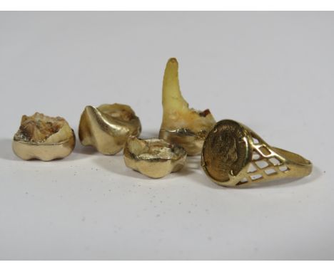 Unusual mixed Gold lot comprising a scrap 9ct gold ring (1.7g) plus a selection of Gold Capped Human Teeth (possibly 16ct)   