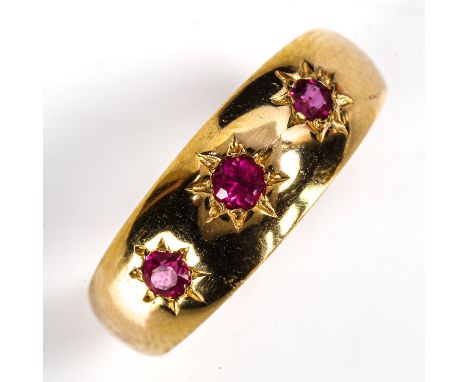 An early 20th century 18ct gold 3-stone ruby gypsy ring, hallmarks London 1918, setting height 6.9mm, size O, 4.3gNo damage o