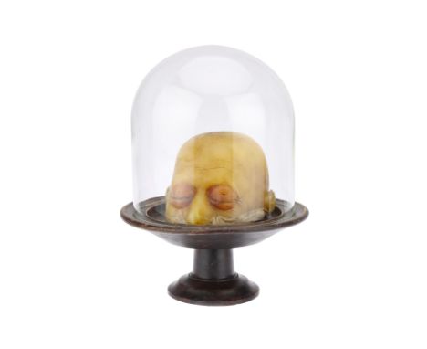 Anatomical Model, a Wax Moulage, 19th century, unsigned, life size wax half-head, showing orbital cellulitis, mounted on turn
